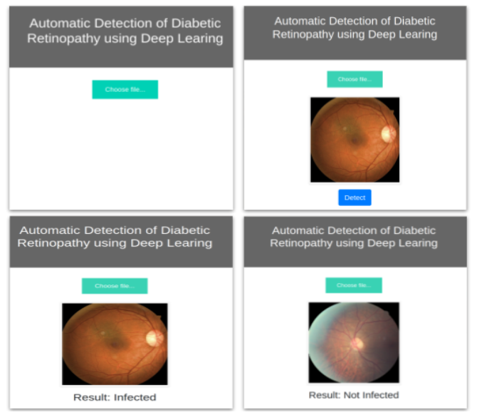 Intelligent software for detection of Diabetic Retinopathy in colour fundus images of retina