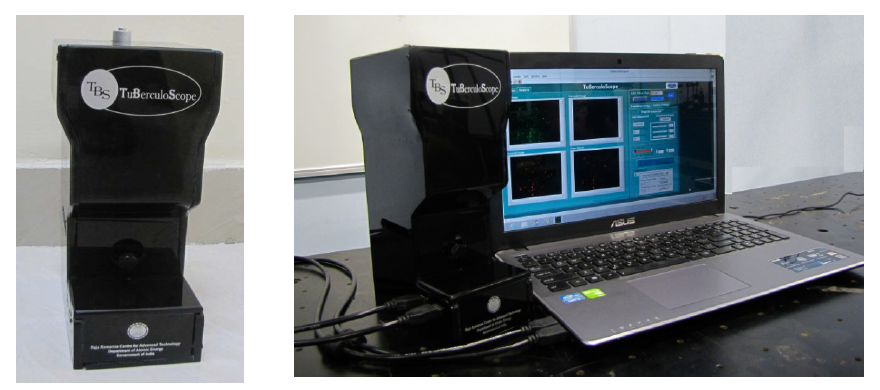 TuBerculoScope along with the Graphic User Interface (GUI) software